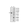 Spike S1 RBD, Fc-Fusion, Avi-Tag, Biotin-labeled (SARS-CoV-2) Recombinant – Figure 1 of 2