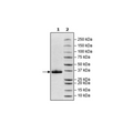 Spike S1 RBD, Avi-His-tag (SARS-CoV-2) Recombinant – Figure 1 of 1
