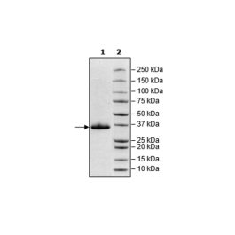 Spike S1 RBD, Avi-His-tag (SARS-CoV-2) Recombinant – Figure 1 of 1
