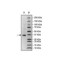 Spike S1 RBD, Avi-His-tag, Biotin-labeled (SARS-CoV-2) Recombinant – Figure 1 of 2