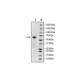 Spike S1 RBD, Fc-Fusion, Avi-Tag (SARS-CoV-2) Recombinant – Figure 1 of 1