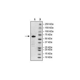 Spike S1 RBD, Fc-Fusion, Avi-Tag (SARS-CoV-2) Recombinant – Figure 1 of 1