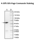 ALK2 (ACVR1) (R206H), GST-Tag Recombinant – Figure 1 of 1