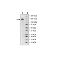 Spike S1 (16-685), Fc Fusion, Avi-tag (SARS-CoV-2) Recombinant – Figure 1 of 2