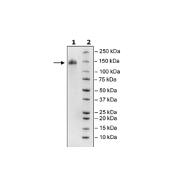 Spike S1 (16-685), Fc Fusion, Avi-tag (SARS-CoV-2) Recombinant – Figure 1 of 2
