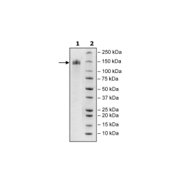 Spike S1 (16-685), Fc Fusion, Avi-tag, Biotin-labeled (SARS-CoV-2) Recombinant – Figure 1 of 4