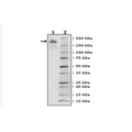 Spike Trimer (S1+S2), His-Tag (SARS-CoV-2) Recombinant – Figure 1 of 2