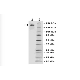 Spike Trimer (S1+S2), His-Tag (SARS-CoV-2) Recombinant – Figure 1 of 2