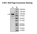 RNA Polymerase, FLAG-tag (SARS-CoV-2) Recombinant – Figure 1 of 1