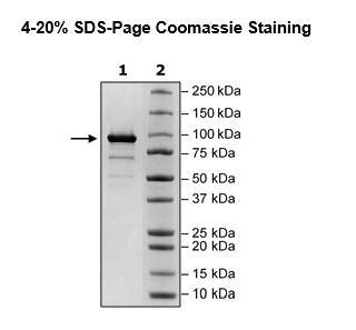 RNA Polymerase, FLAG-tag (SARS-CoV-2) Recombinant – Figure 1 of 1