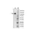 Spike S1 (16-685), Avi-His-tag (SARS-CoV-2) Recombinant – Figure 1 of 2