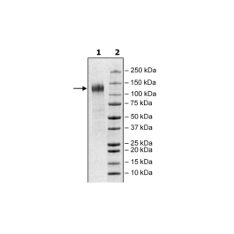 Spike S1 (16-685), Avi-His-tag (SARS-CoV-2) Recombinant – Figure 1 of 2