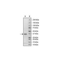 PLPro, His-Tag (SARS-CoV-2) Recombinant – Figure 1 of 2