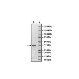 PLPro, His-Tag (SARS-CoV-2) Recombinant – Figure 1 of 2