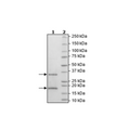 NSP10/NSP16 Complex (SARS-CoV-2) Recombinant – Figure 1 of 1