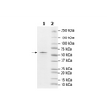 SOS1, FLAG-Tag, Avi-Tag, Biotin-Labeled Recombinant – Figure 1 of 2