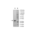 CLPP, His-Tag Recombinant – Figure 1 of 1