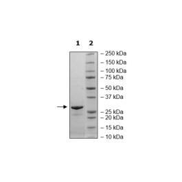 CLPP, His-Tag Recombinant – Figure 1 of 1
