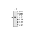 Nucleocapsid Protein, Avi-His-tag, Biotin-Labeled (SARS-CoV-2) – Figure 1 of 1