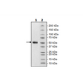 Spike S1 Neutralizing Antibody (VHH), Fc-fusion (IgG1), Avi-Tag (SARS-CoV-1), Biotin-labeled – Figure 1 of 2