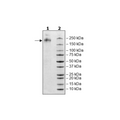 Spike Trimer (S1+S2), His-tag (HCoV-NL63) Recombinant – Figure 1 of 1