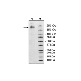 Spike Trimer (S1+S2), His-tag (HCoV-NL63) Recombinant – Figure 1 of 1