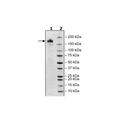 Spike Trimer (S1+S2), His-tag (SARS-CoV-1) Recombinant – Figure 1 of 1