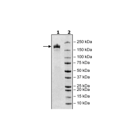 Spike Trimer (S1+S2), His-tag (SARS-CoV-1) Recombinant – Figure 1 of 1