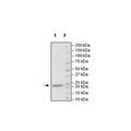 NRAS (Q61K), His-Tag Recombinant – Figure 1 of 1