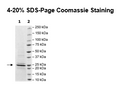 KRAS (G12C), Isoform B, His-Tag (Sf9-derived) Recombinant – Figure 1 of 1
