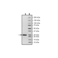 KRAS (G12R), Isoform B, His-Tag (Sf9-derived) Recombinant – Figure 1 of 1