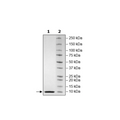 NSP7, His-tag (SARS-CoV-2) Recombinant – Figure 1 of 1