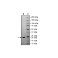 NSP8, His-tag (SARS-CoV-2) Recombinant – Figure 1 of 1