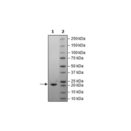 NSP8, His-tag (SARS-CoV-2) Recombinant – Figure 1 of 1