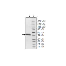 Spike S1 RBD (V483A), Avi-His-tag (SARS-CoV-2) Recombinant – Figure 1 of 1