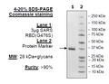 Spike S1 RBD (G476S), Avi-His-tag (SARS-CoV-2) Recombinant – Figure 1 of 2