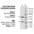 Anti-RANKL Neutralizing Antibody – Figure 1 of 3
