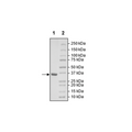 PLPro (1541-1857), His-tag (SARS-CoV-1) Recombinant – Figure 1 of 1