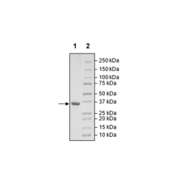 PLPro (1541-1857), His-tag (SARS-CoV-1) Recombinant – Figure 1 of 1