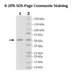 FGFR3 (397-806(end)) (K650M) His-Tag (Dephosphorylated) Recombinant – Figure 1 of 1