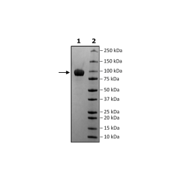 IL6R, Fc-Fusion (IgG1) Recombinant – Figure 1 of 1
