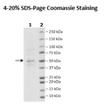 FGFR3 (N540K) His-Tag (Dephosphorylated), Biotin-Labeled Recombinant – Figure 1 of 1