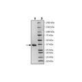 Spike S1 RBD, His-Avi-Tag, Biotin-Labeled (SARS-CoV-2) Recombinant – Figure 1 of 2