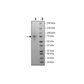 CD55, Avi-His-Tag, Biotin-labeled Recombinant – Figure 1 of 2