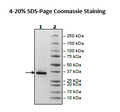 CD38, His-Tag (Dog) Recombinant – Figure 1 of 2