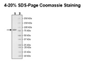 DGKa, His-Avi-Tag, Biotin-Labeled Recombinant – Figure 1 of 2