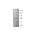 Spike RBD (B.1.1.7, Alpha Variant), Avi-His-Tag (SARS-CoV-2) Recombinant – Figure 1 of 1
