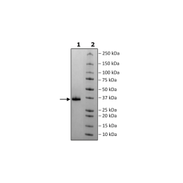 Spike RBD (B.1.1.7, Alpha Variant), Avi-His-Tag (SARS-CoV-2) Recombinant – Figure 1 of 1