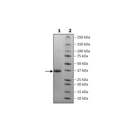 Spike RBD (B.1.351, Beta Variant) Avi-His-Tag (SARS-CoV-2) Recombinant – Figure 1 of 2