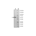 Nucleocapsid Protein (B.1.351, Beta Variant), Avi-His-Tag (SARS-CoV-2) Recombinant – Figure 1 of 1